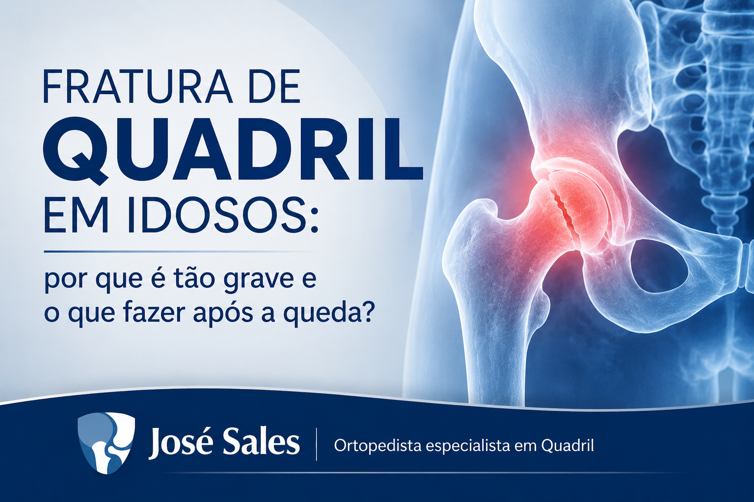 fratura de quadril
