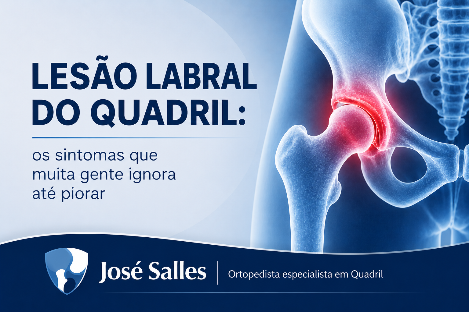 lesão labral do quadril