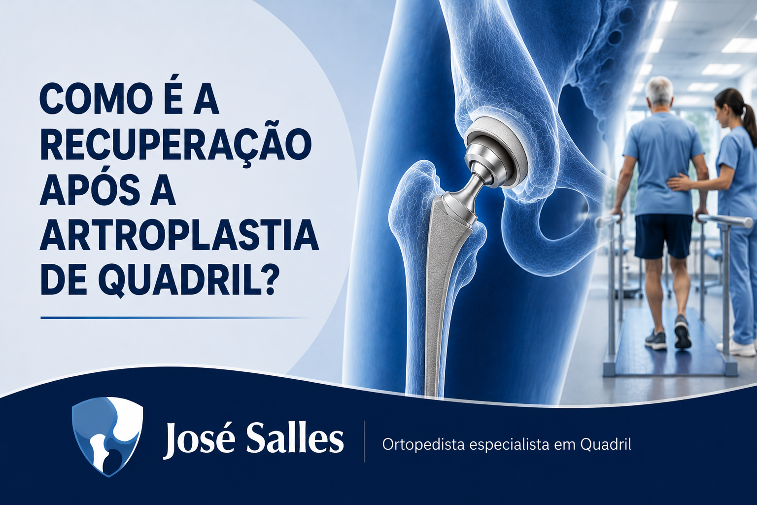 artroplastia de quadril