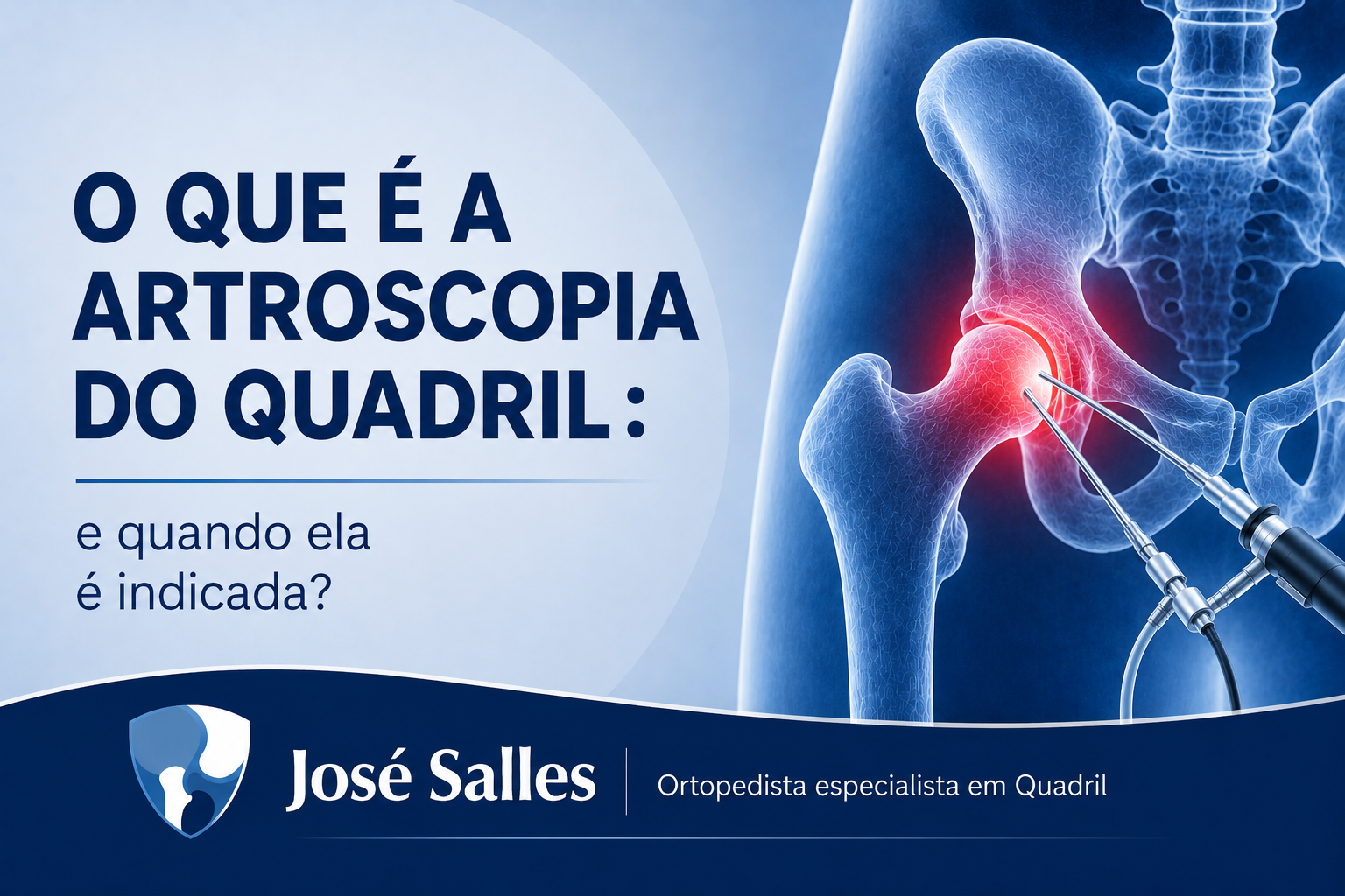 artroscopia do quadril