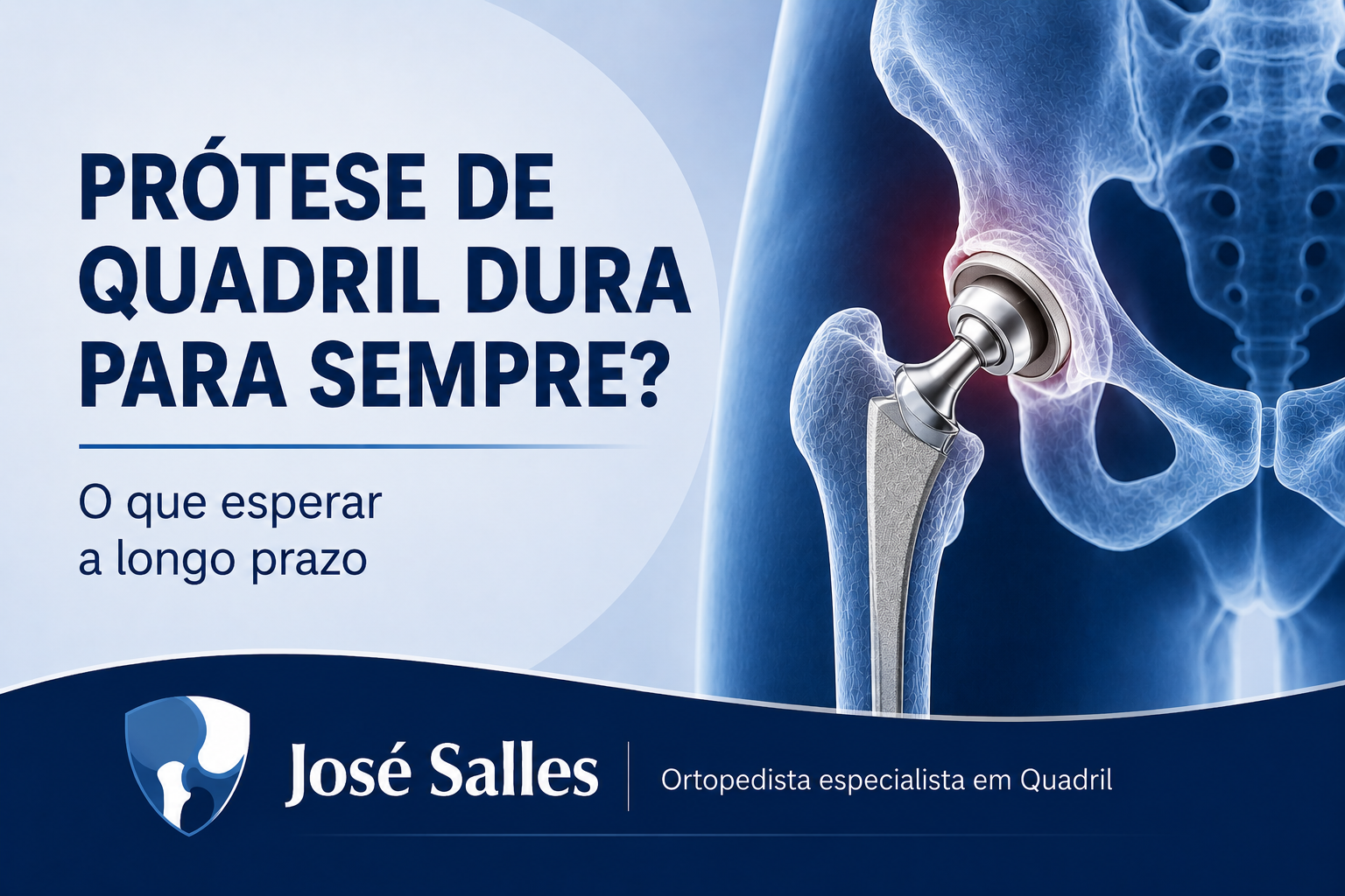 pr?tese de quadril