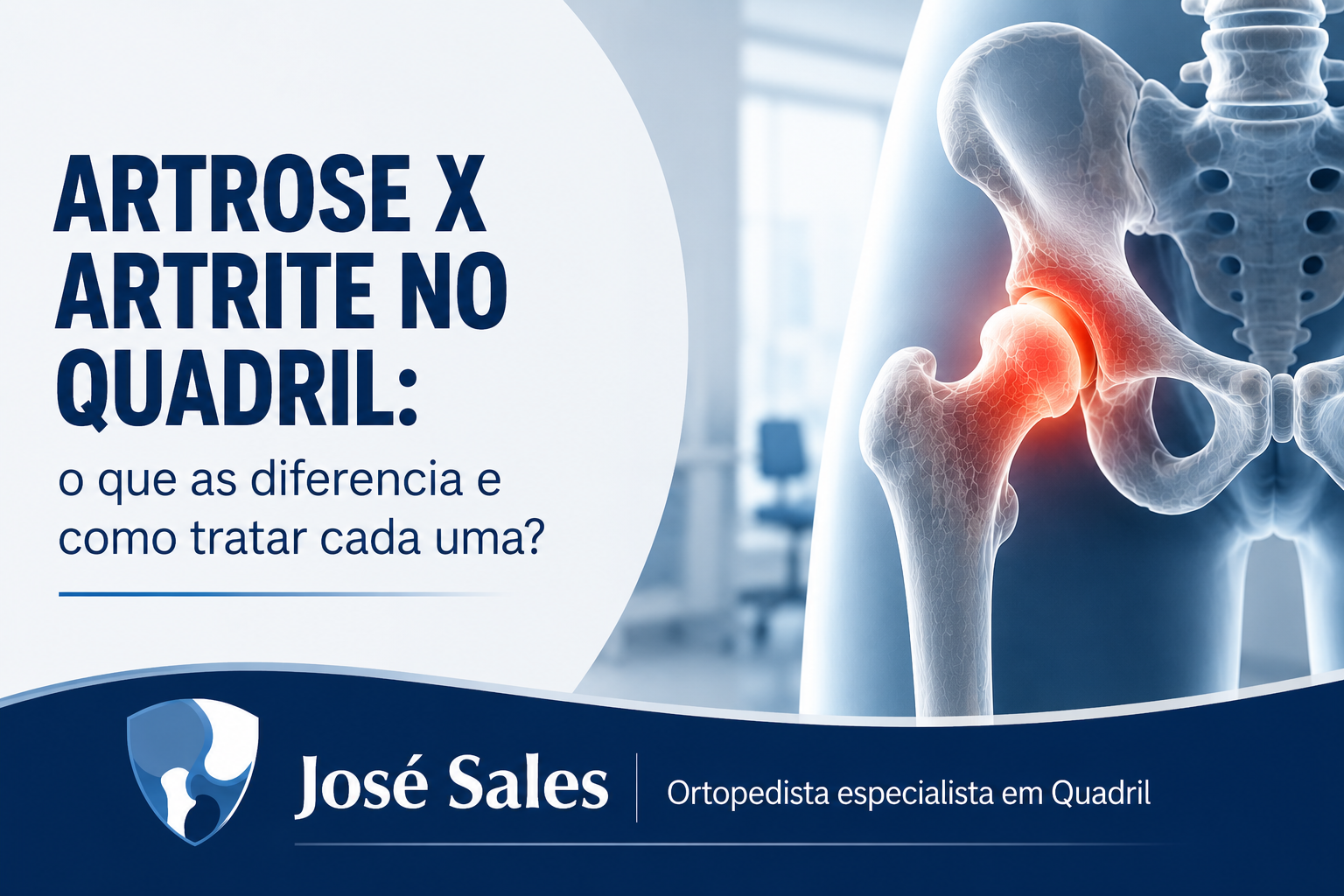 artrose